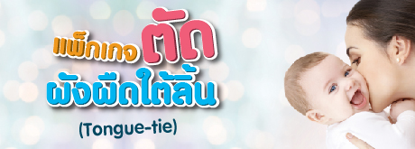 แพ็กเกจตัดผังผืดใต้ลิ้น